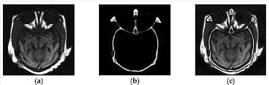 IF in Medical Imagery 