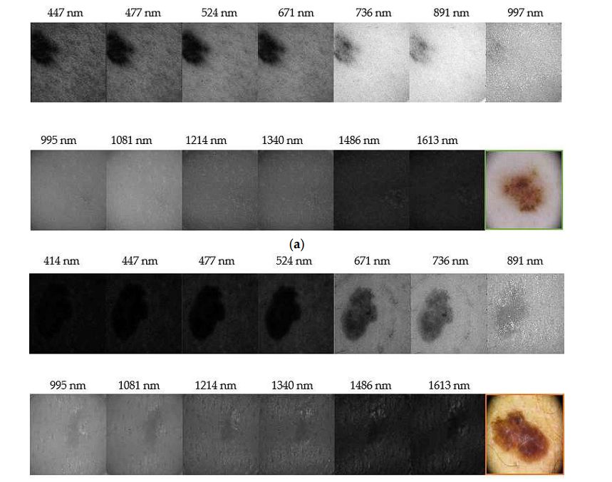 image of skin-cancer-detection-multispectral-imaging