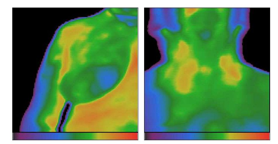 image of Thermovisual